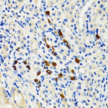 Anti-ODC1 Antibody