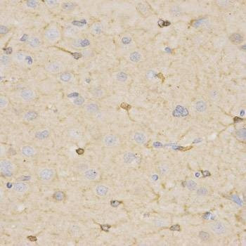Anti-HSD17B2 Antibody