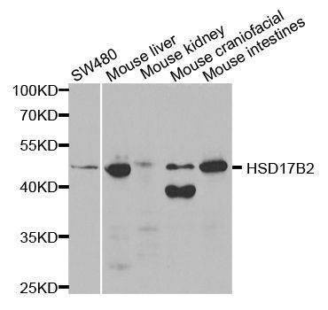 Anti-HSD17B2 Antibody