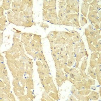 Anti-PSMC2 Antibody