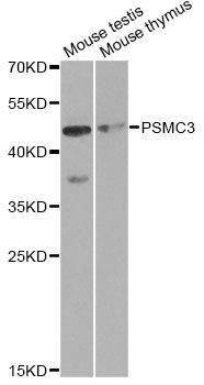 Anti-PSMC3 Antibody