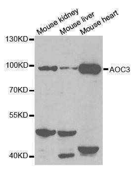 Anti-AOC3 Antibody