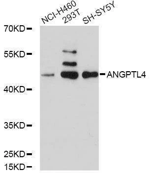 Anti-ANGPTL4 Antibody