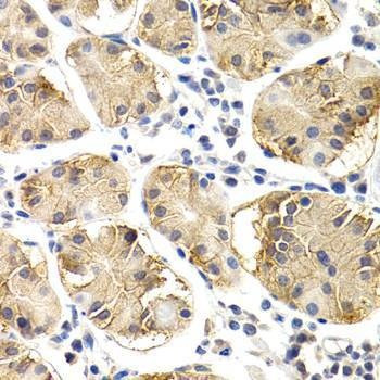 Anti-CHIT1 Antibody