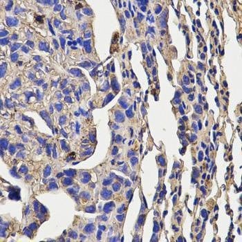 Anti-KLRD1 Antibody