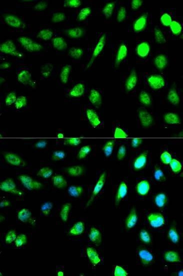 Anti-KLRD1 Antibody