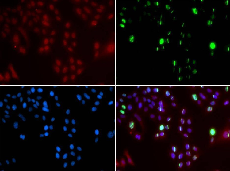 Anti-FANCD2 Antibody