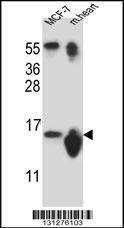 Anti-SNRPD3 (N-term) Antibody