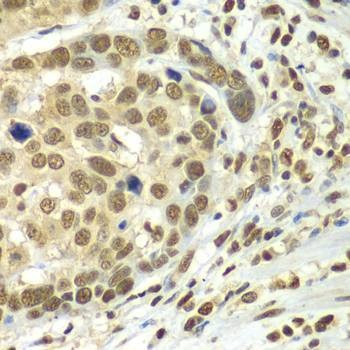 Anti-HDAC2 Antibody