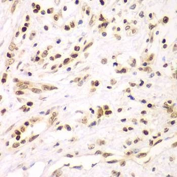 Anti-IKBKB Antibody