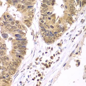 Anti-IKBKB Antibody