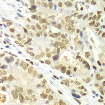 Anti-IKBKB Antibody