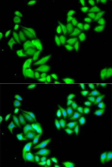 Anti-IKBKB Antibody