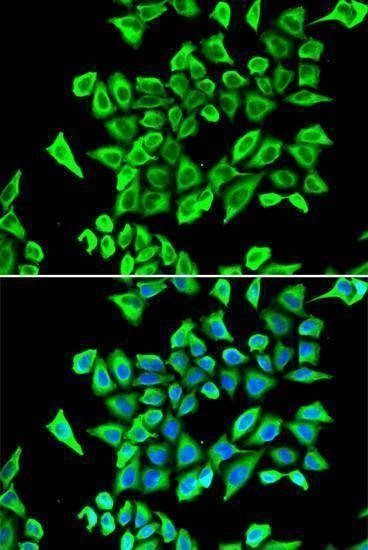 Anti-LCN2 Antibody