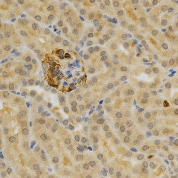 Anti-TNFRSF11B Antibody