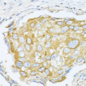 Anti-MAPK10 Antibody