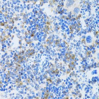 Anti-MAPK10 Antibody