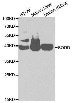 Anti-SORD Antibody
