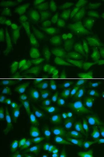 Anti-SORD Antibody