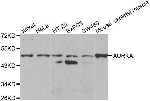 Anti-AURKA Antibody
