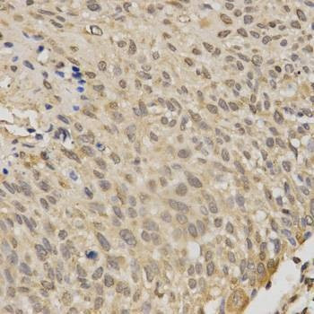 Anti-STK11 Antibody