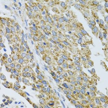 Anti-CYP1A1 Antibody