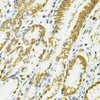 Anti-HLA-DQA1 Antibody