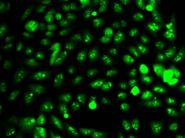 Anti-IDH1 Antibody
