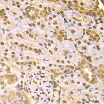 Anti-MAP2K7 Antibody