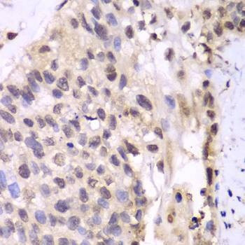 Anti-PSMA6 Antibody