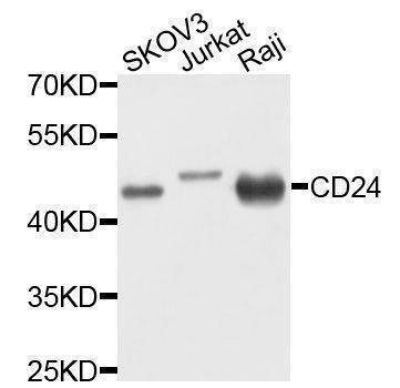 Anti-CD24 Antibody