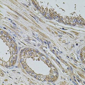 Anti-PDCD6IP Antibody