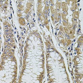 Anti-PDCD6IP Antibody