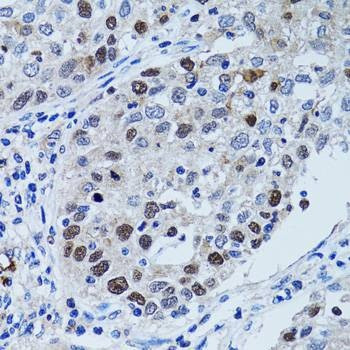 Anti-UHRF1 Antibody