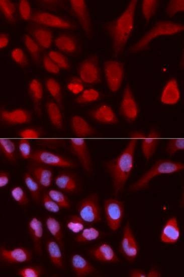 Anti-UHRF1 Antibody