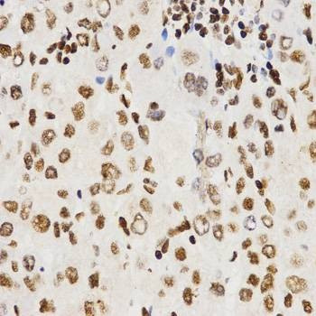 Anti-HIST3H3 Antibody
