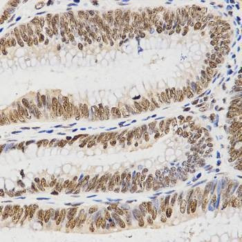 Anti-HIST3H3 Antibody