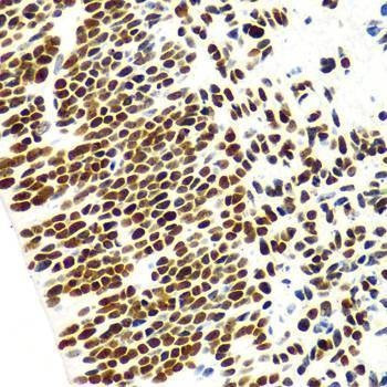 Anti-HIST3H3 Antibody