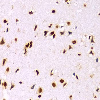Anti-HIST3H3 Antibody