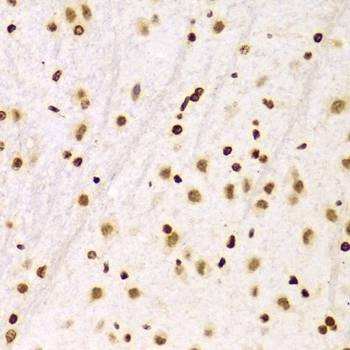 Anti-HIST3H3 Antibody