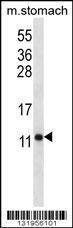 Anti-ATP5J (Center) Antibody