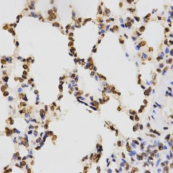 Anti-TriMethyl-Histone H3-K9 Antibody