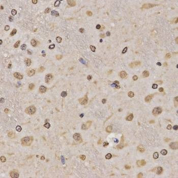Anti-MonoMethyl-Histone H3-K36 Antibody