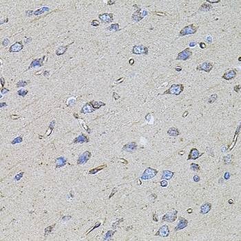Anti-FLNB Antibody