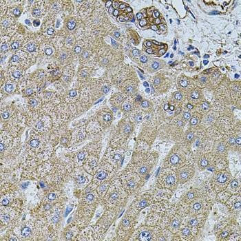 Anti-FLNB Antibody