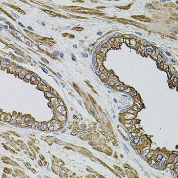 Anti-FLNB Antibody