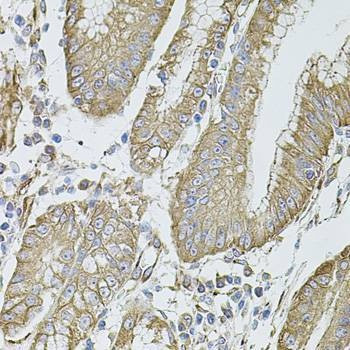 Anti-FLNB Antibody