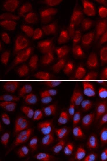 Anti-EPB41 Antibody