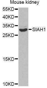 Anti-SIAH1 Antibody