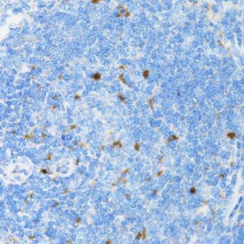 Anti-SIAH1 Antibody